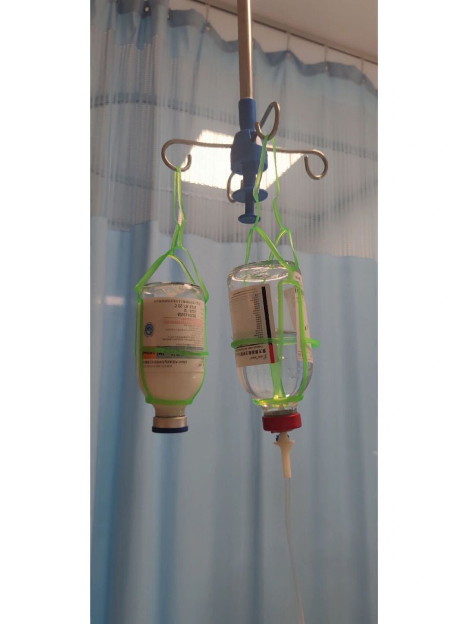 (六)缺血缺氧脑病昏迷3个月 2月25日 今天昏迷93天 已经超过三个月了