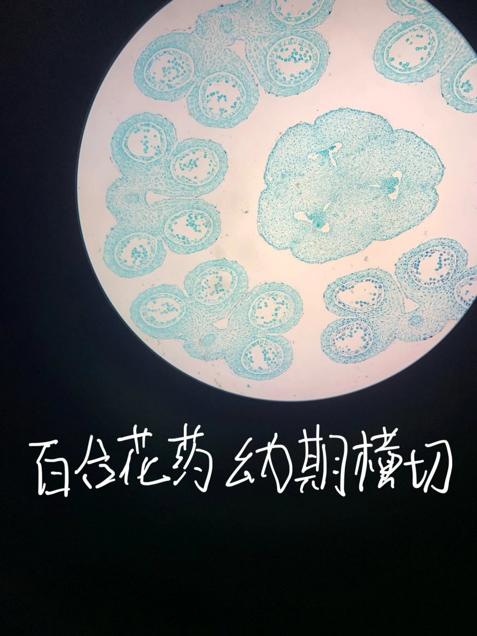 百合子房二分体期切片 5.百合胚珠胚囊内四核期 6.