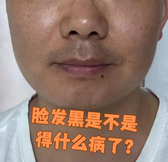 脸发黑可能是正常现象,也可能是生病了