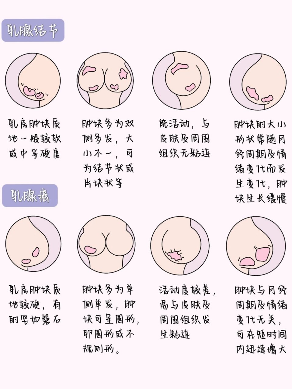 医学生笔记7199(妇科篇)/乳头内陷      乳房自检六步骤 ①举手
