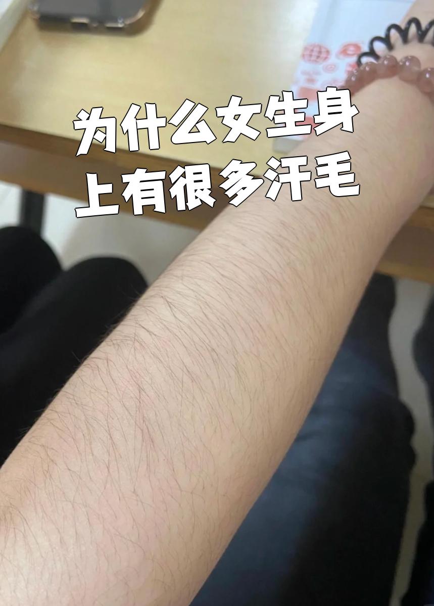 为什么女生身上有很多汗毛