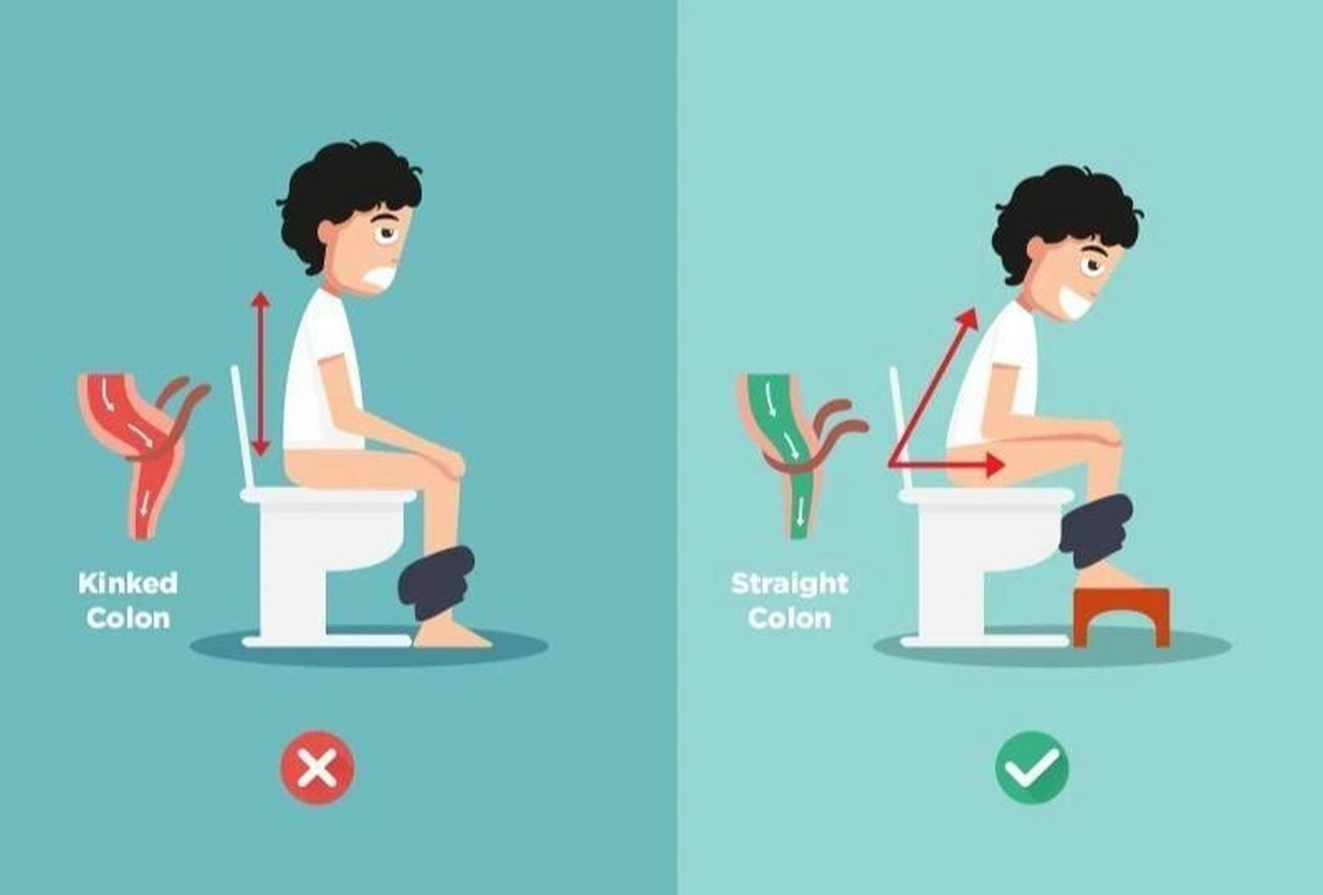 你的排便姿势错啦!应该这样拉屎!