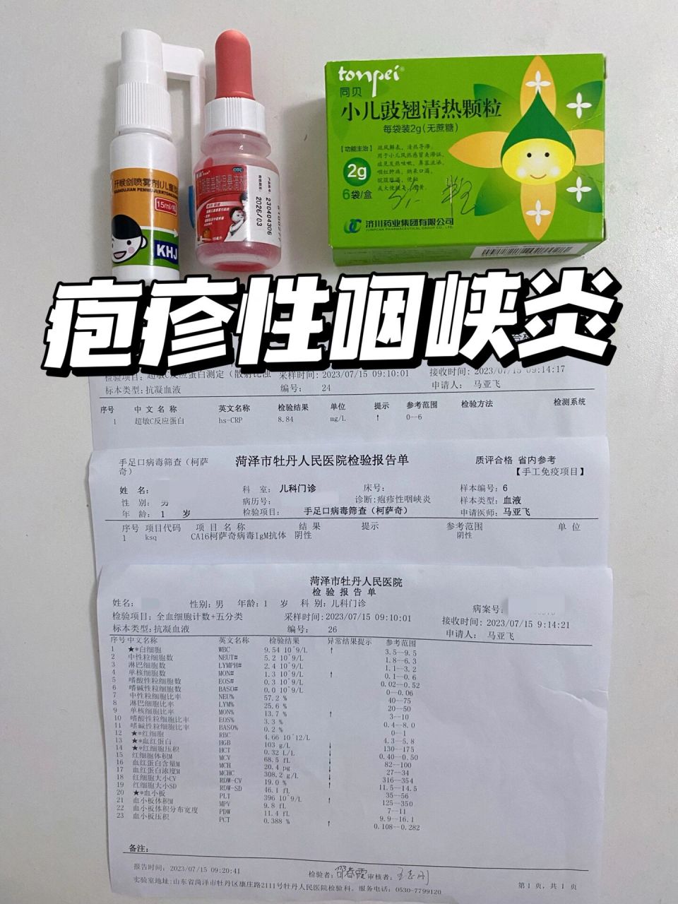 15个月宝宝疱疹性咽峡炎3天痊愈过程 不幸中招疱疹性咽峡炎,从反复