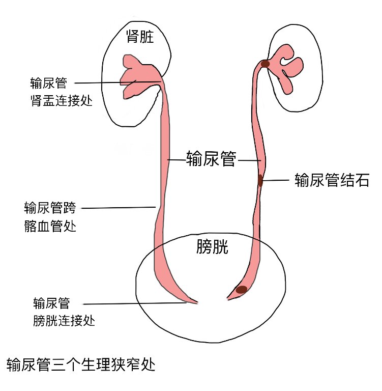 输尿管第三狭窄处图图片