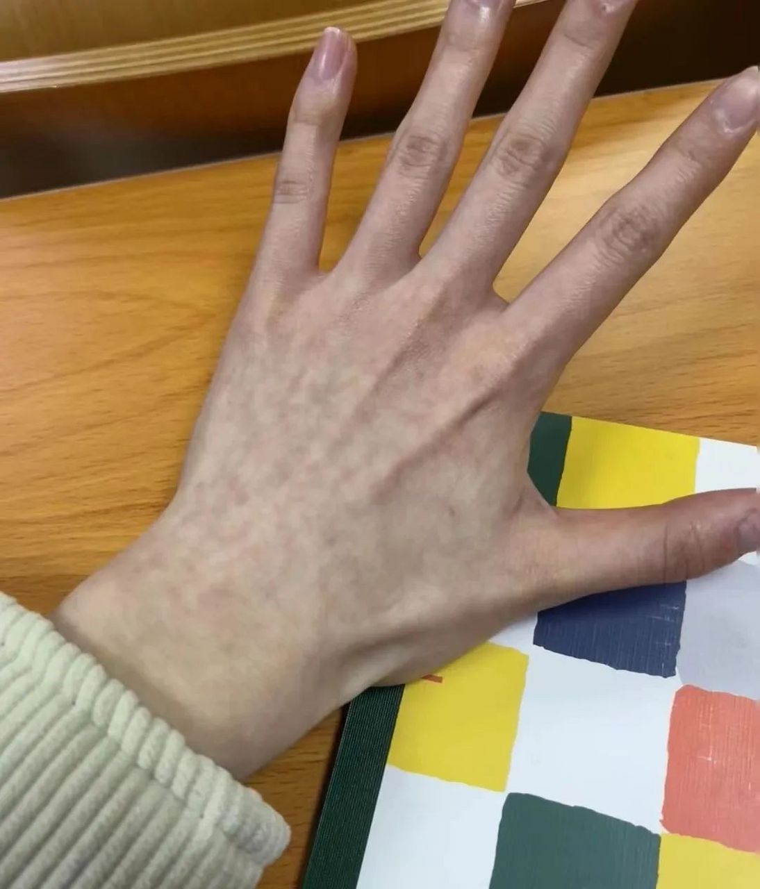 不需要天气预报的体质 空气一下降皮肤就变得青紫的人 其实是对冷空气