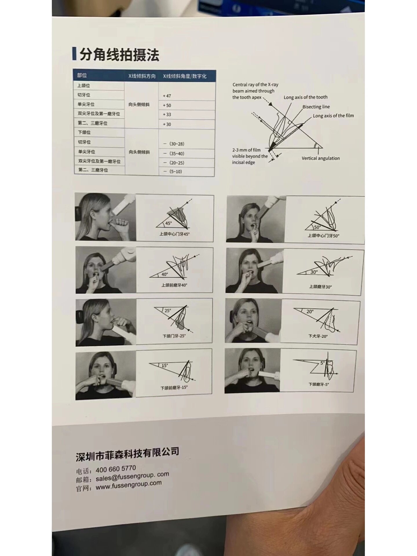 小牙片拍摄方法