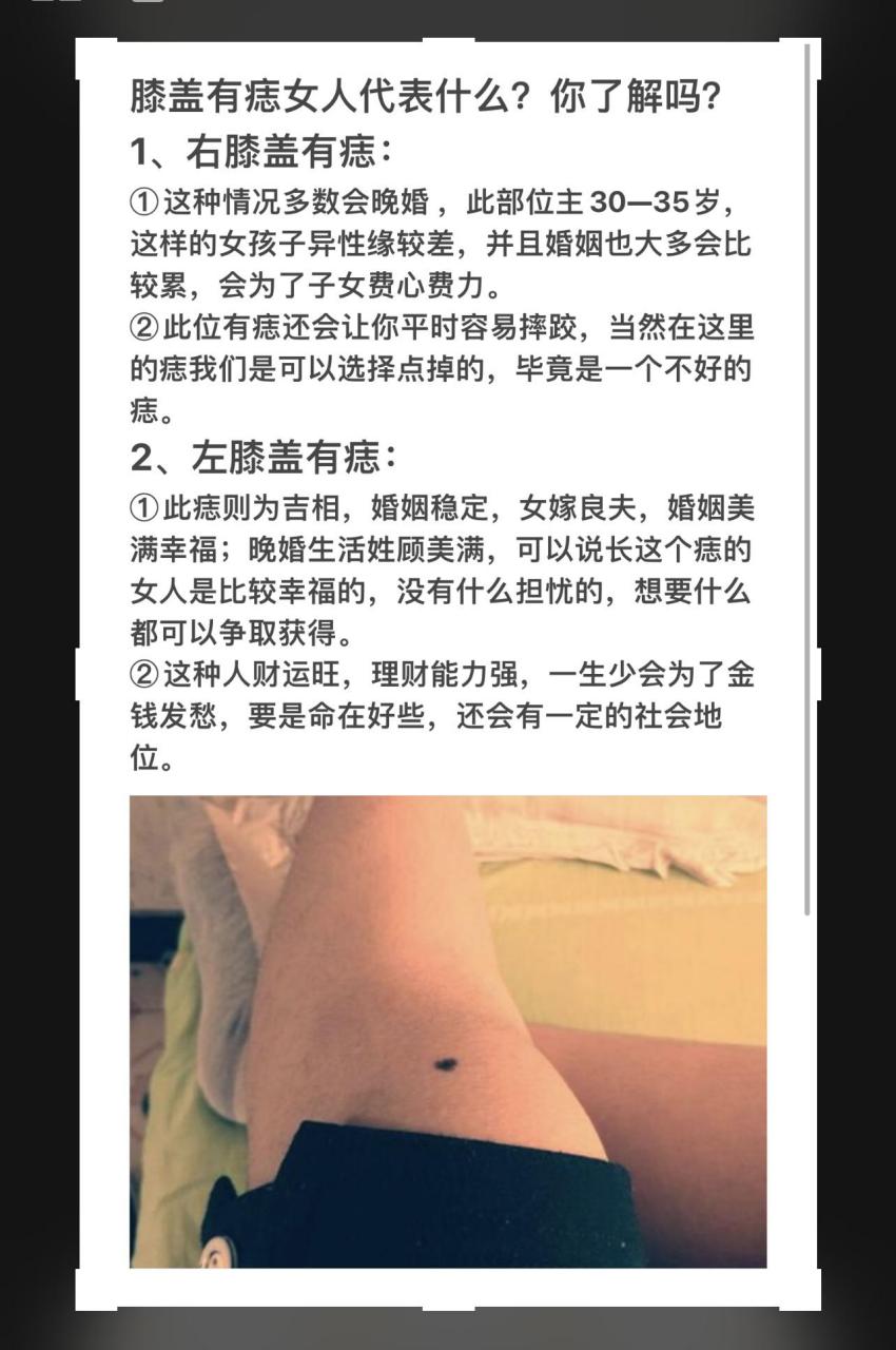 膝盖长痣的女人,他们就需要在自己的婚姻方面多多注意一下了,因为他们