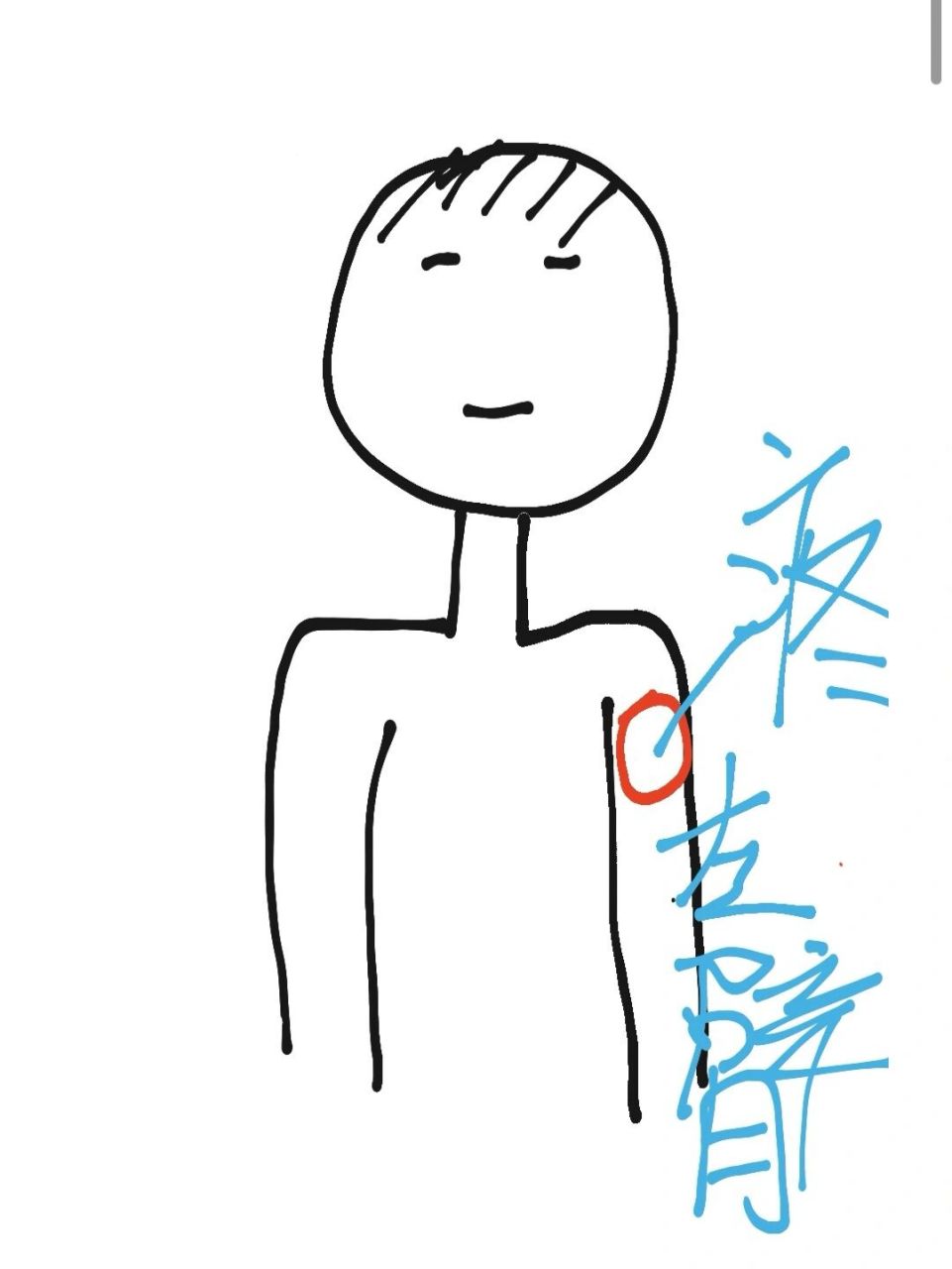 左胳膊上臂好疼!