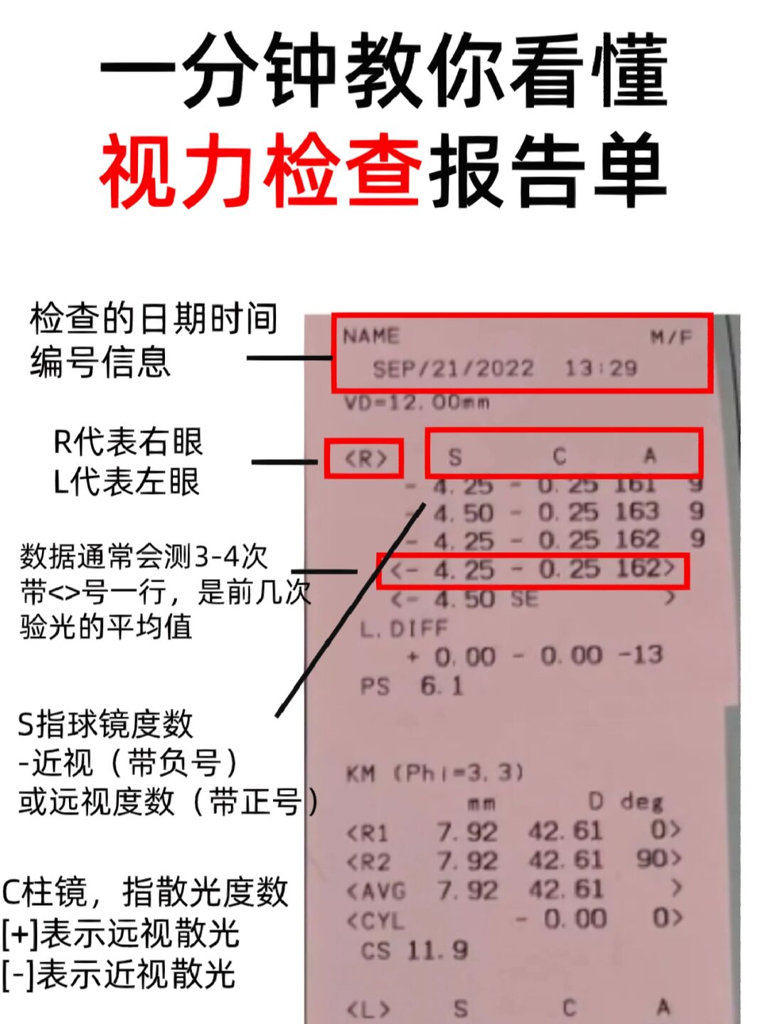 一分钟教你看懂视力检查报告05赶紧get
