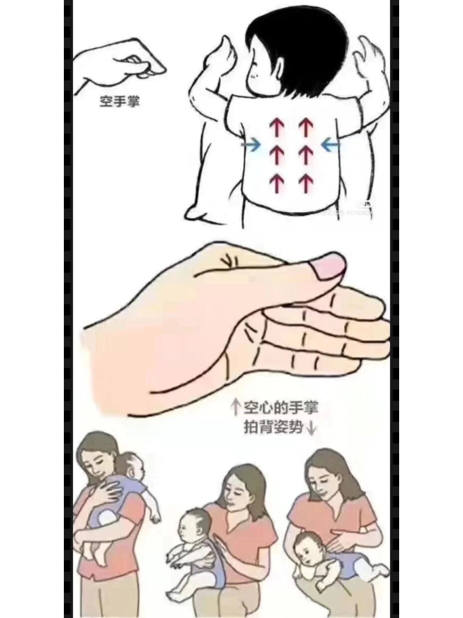 小儿排痰拍背正确方法