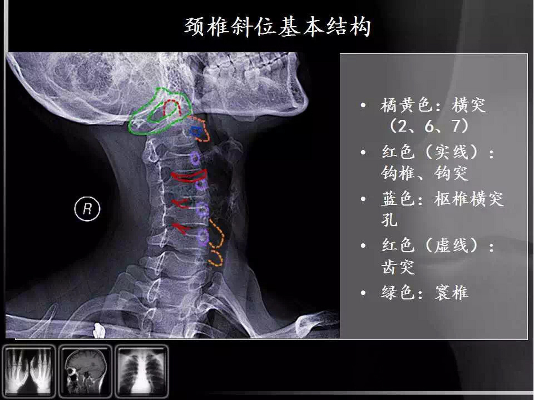 颈椎DR解剖图片