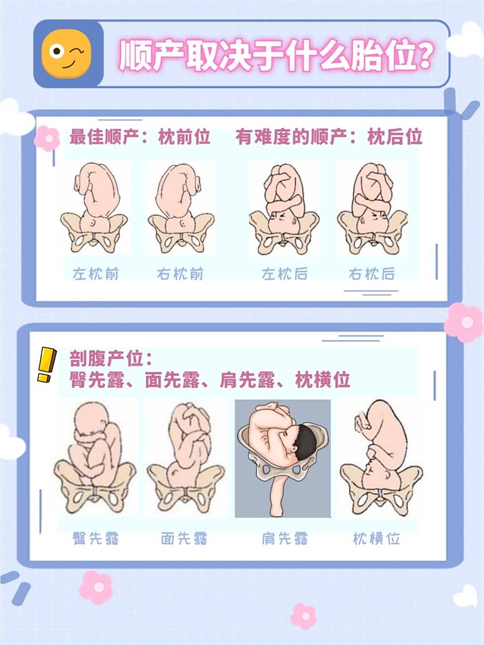 最佳顺产胎位:枕前位,包括左枕前和右枕前 	 枕后位也是可以顺驳哪