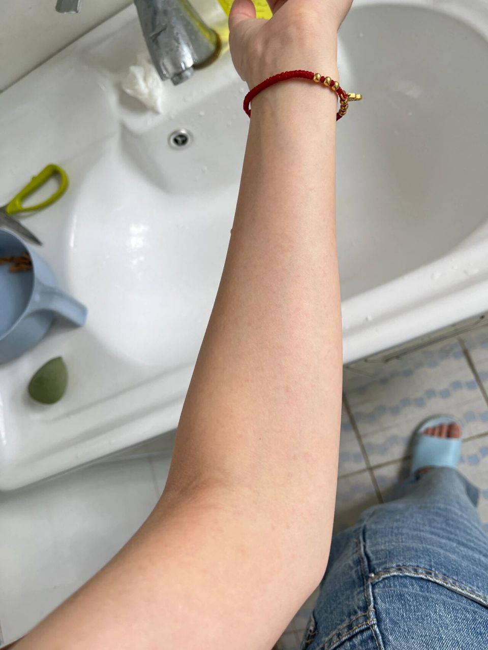 晒太阳后手臂出现红点 百度说是紫外线过敏?我?怎么可能?不敢相信