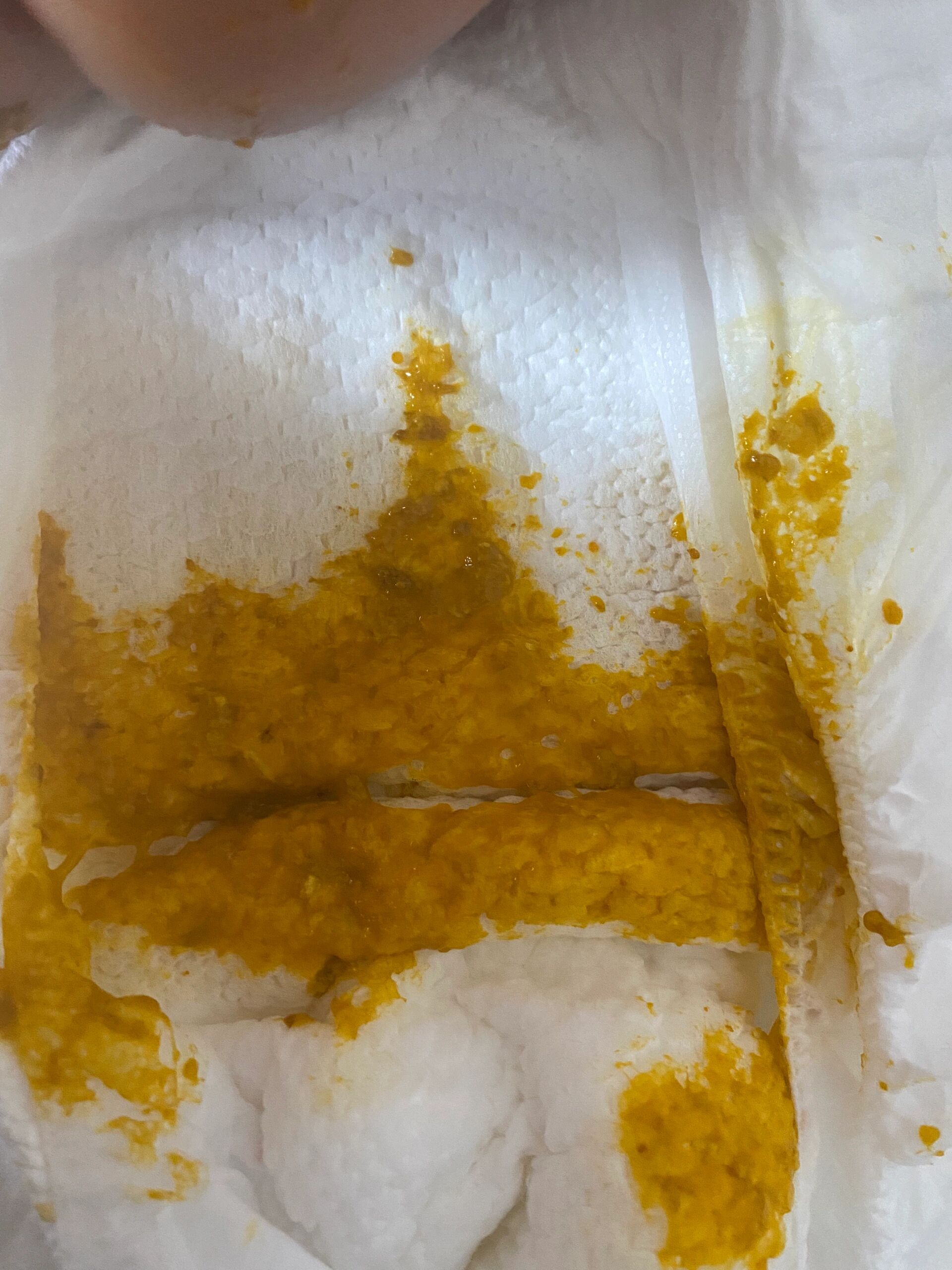 小月龄宝宝大便次数多正常吗?