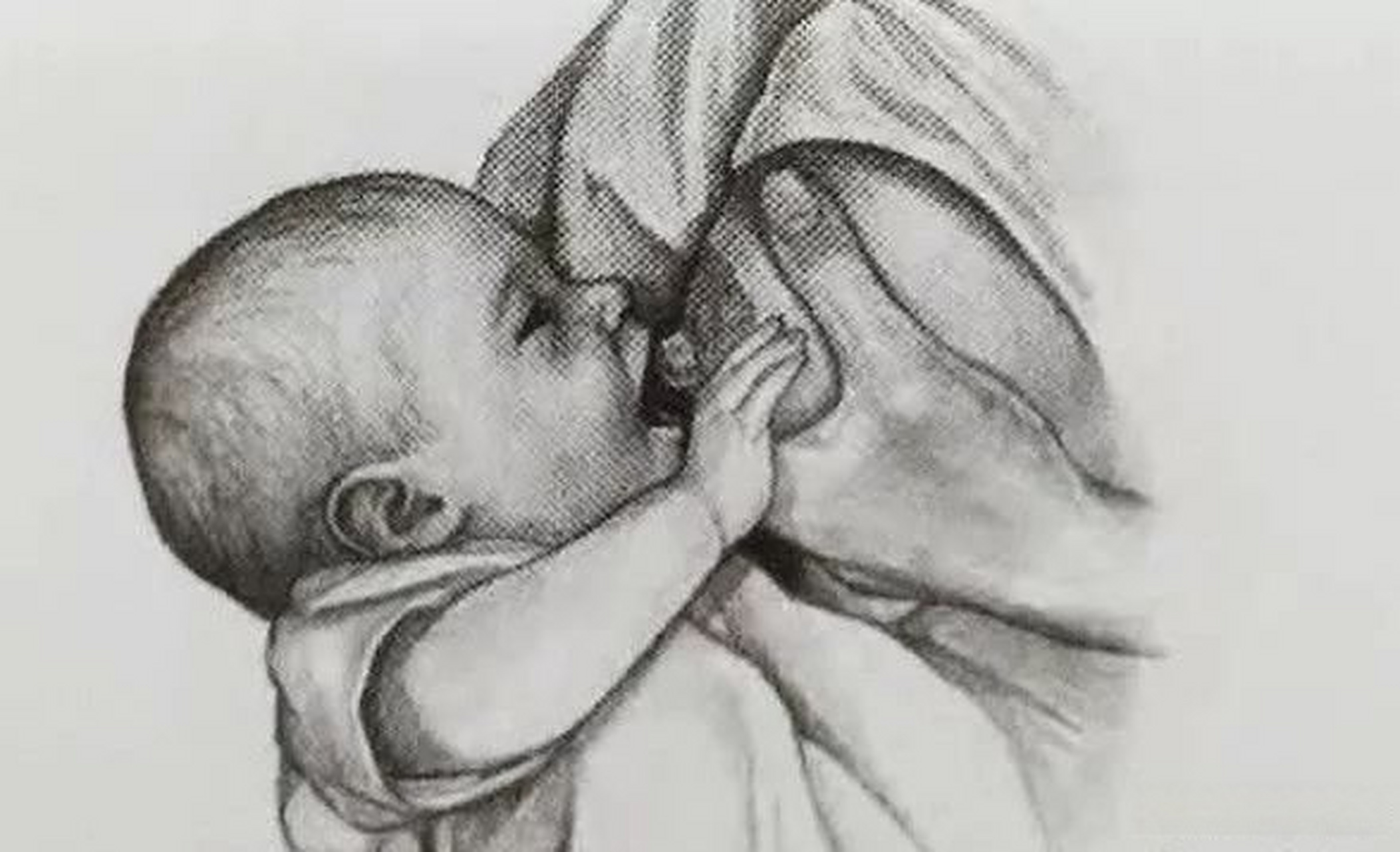 病情诊断: 乳头流黄水可能是乳腺导管炎症,乳腺囊肿