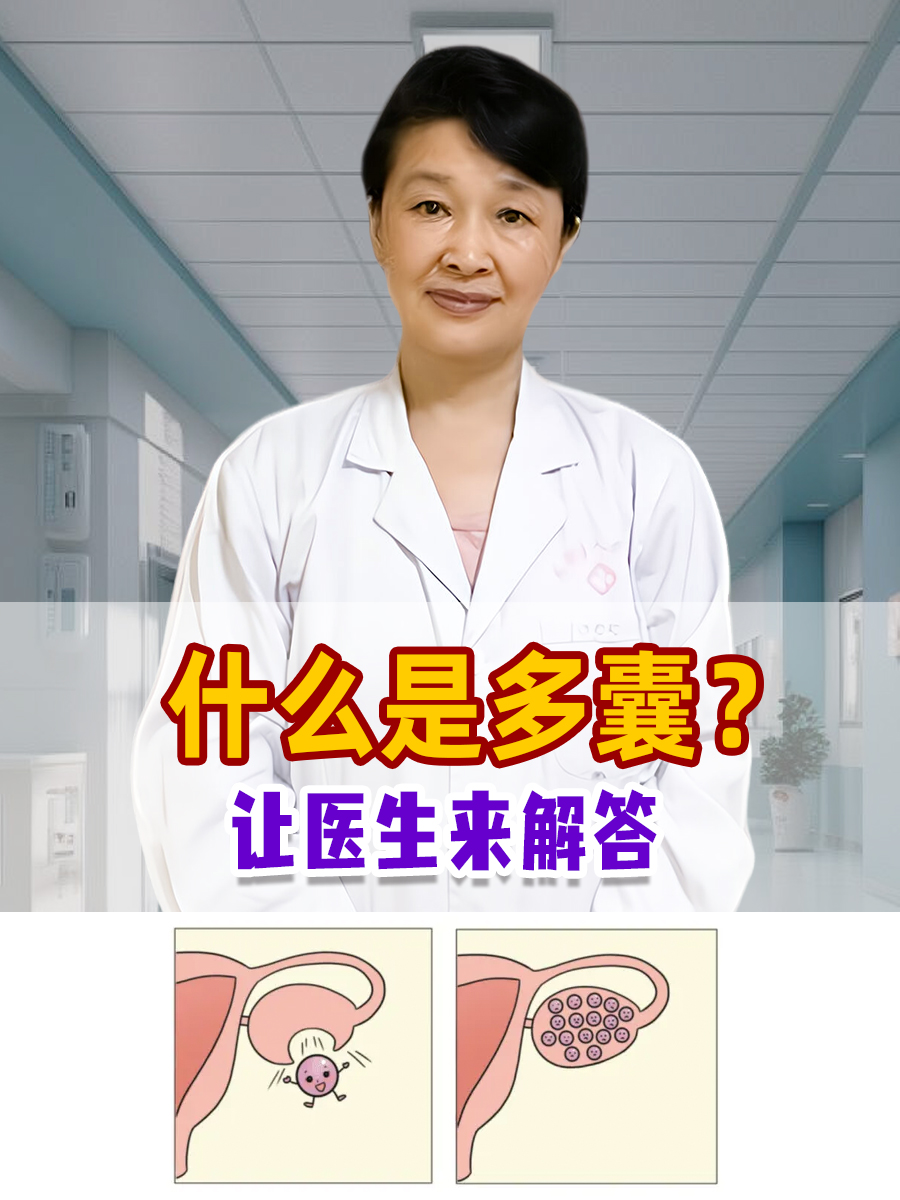 多卵巢是什么引起(多卵巢是什么意思对身体有什么害处吗)