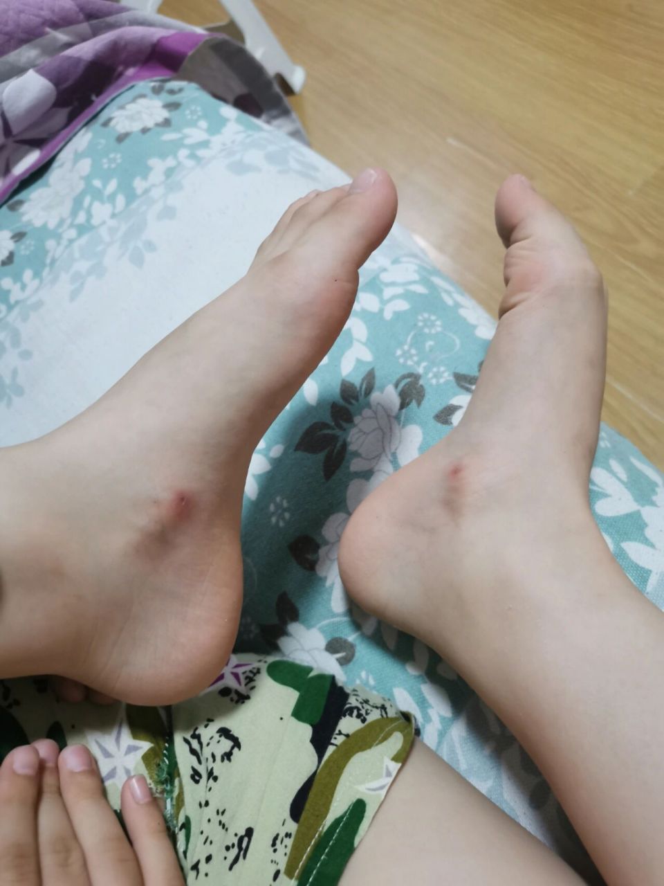 7岁小孩的脚这块骨头突出正常吗?