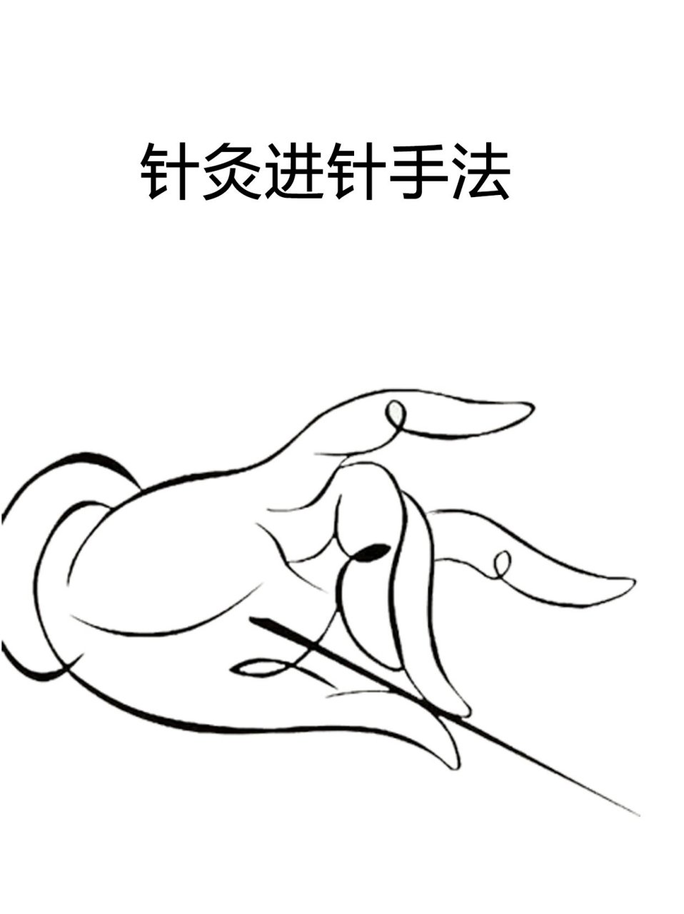 操作手势为:右手拇,食二指持针,中指靠紧穴位,并用指腹抵住针体中部