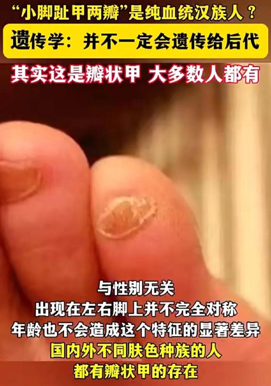 其实瓣状甲在国内外不同肤色种族的人群中都有大量存在,它是多个微效