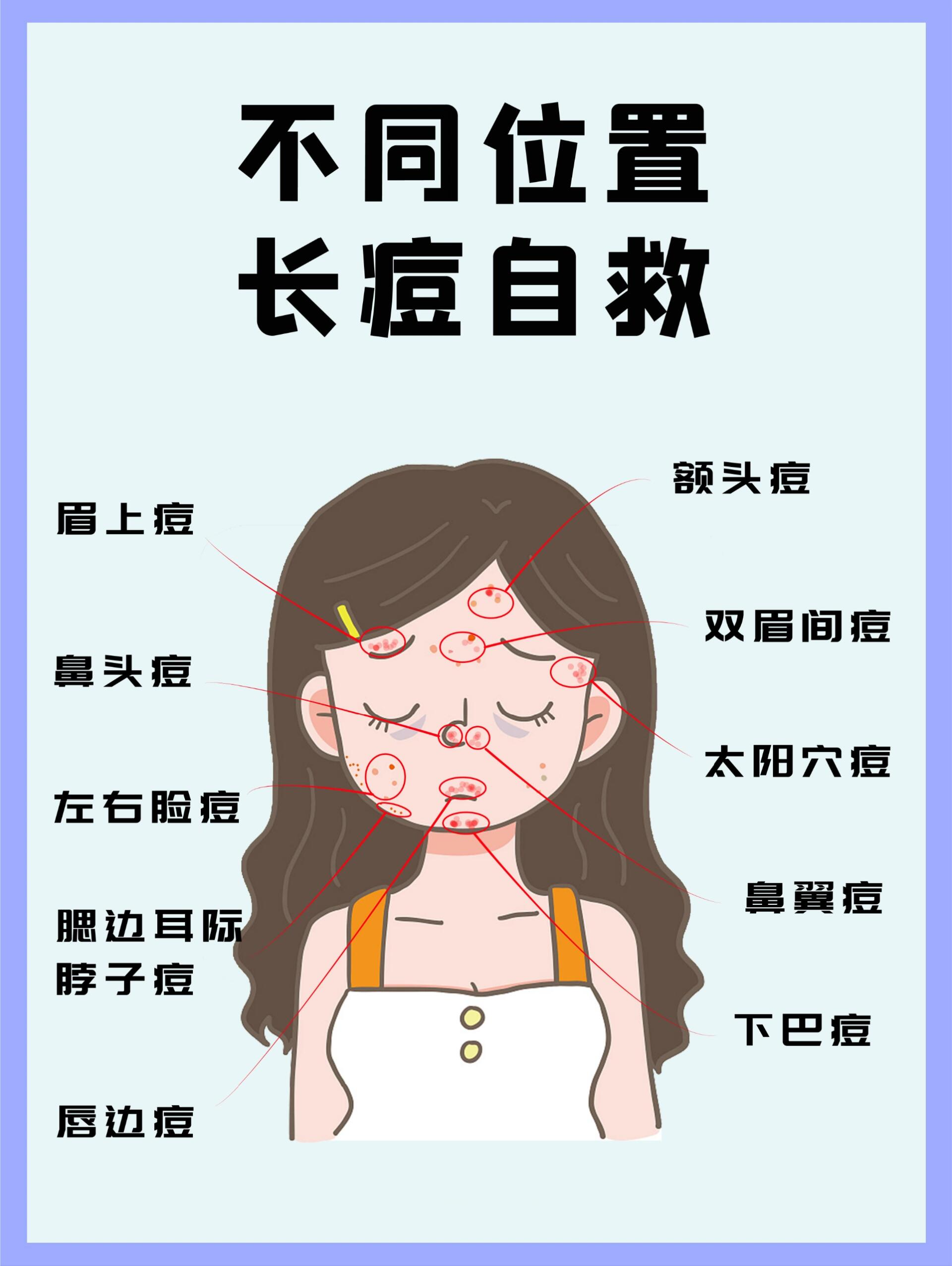 所以想要知道怎么脸上不长痘或者祛痘,先要抓住痘痘的成因,原由