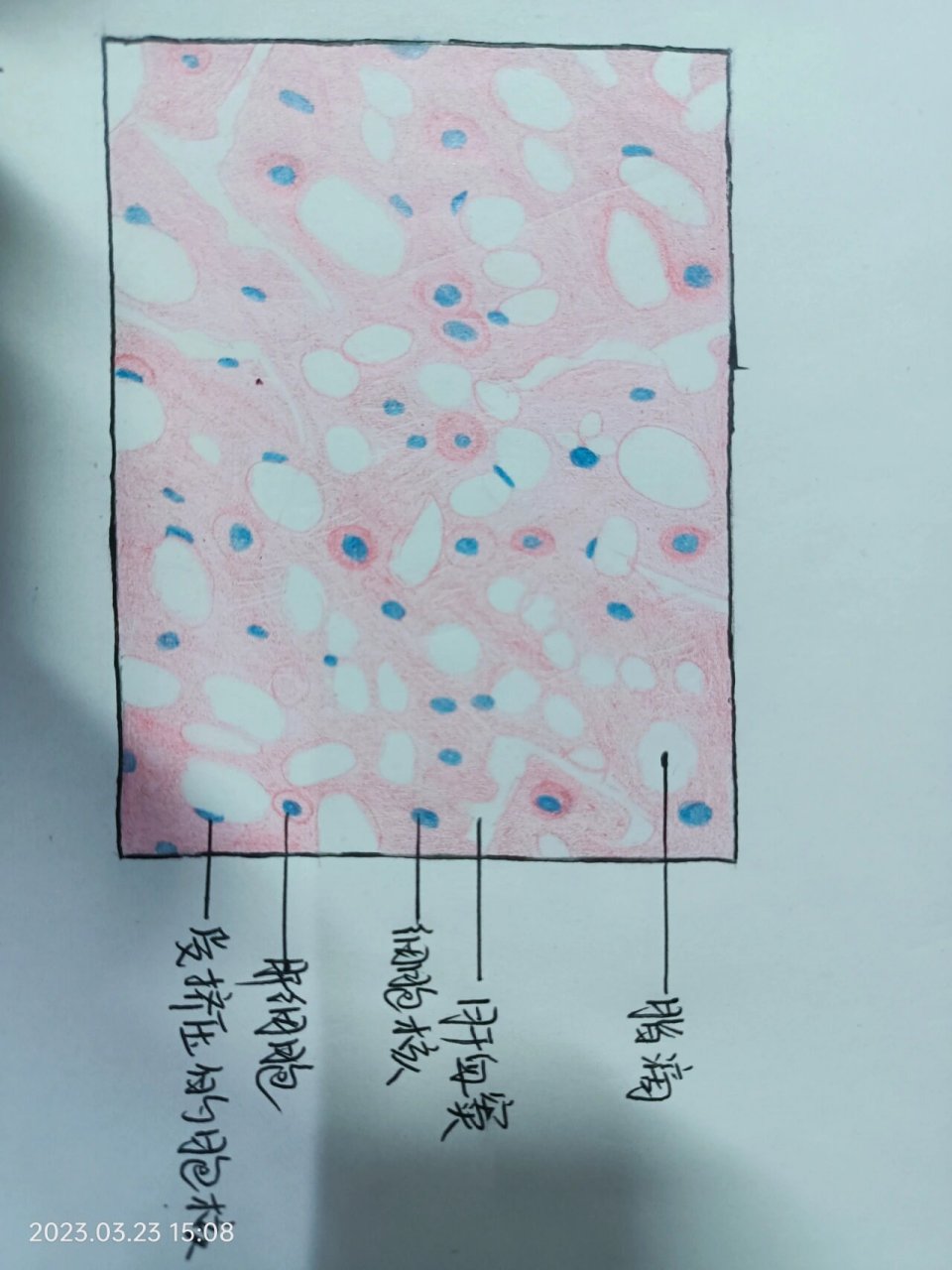 病理肝细胞脂肪变