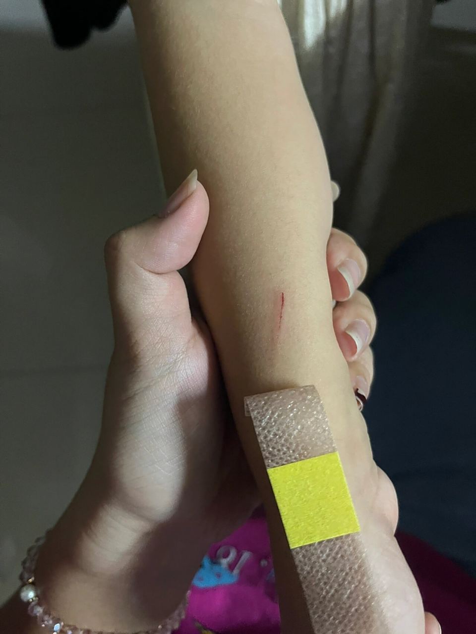 不确定是否狗抓伤,狂犬疫苗打一针后不打行 不确定是否狗狗抓伤的,家