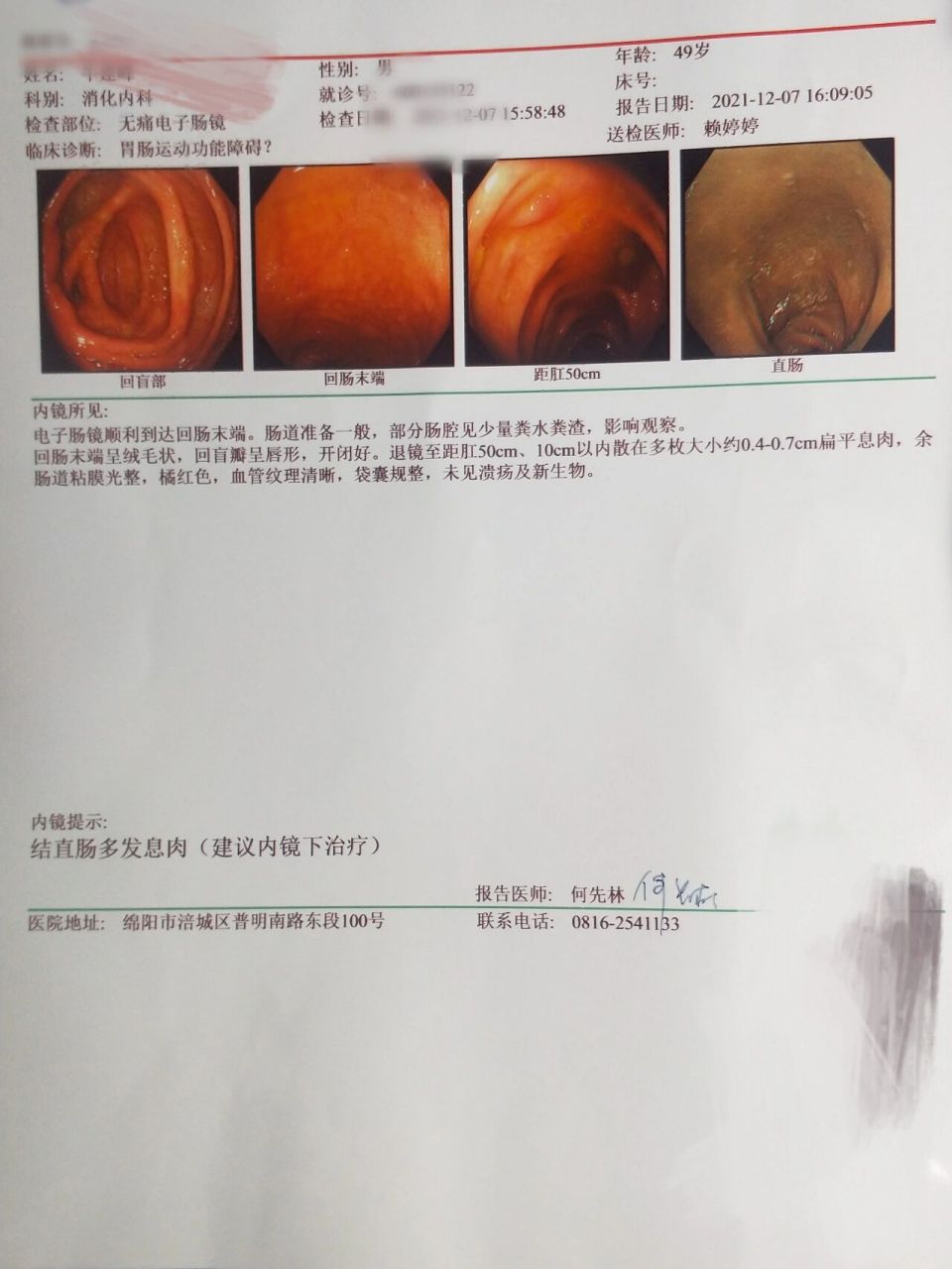 结直肠多发息肉到底做不做息肉切除 朋友们帮我看看 我爱人这个病情严