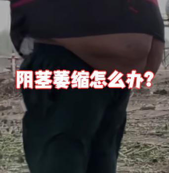 阴茎萎缩的治疗方法包括减肥,戒烟,营养补充,激素