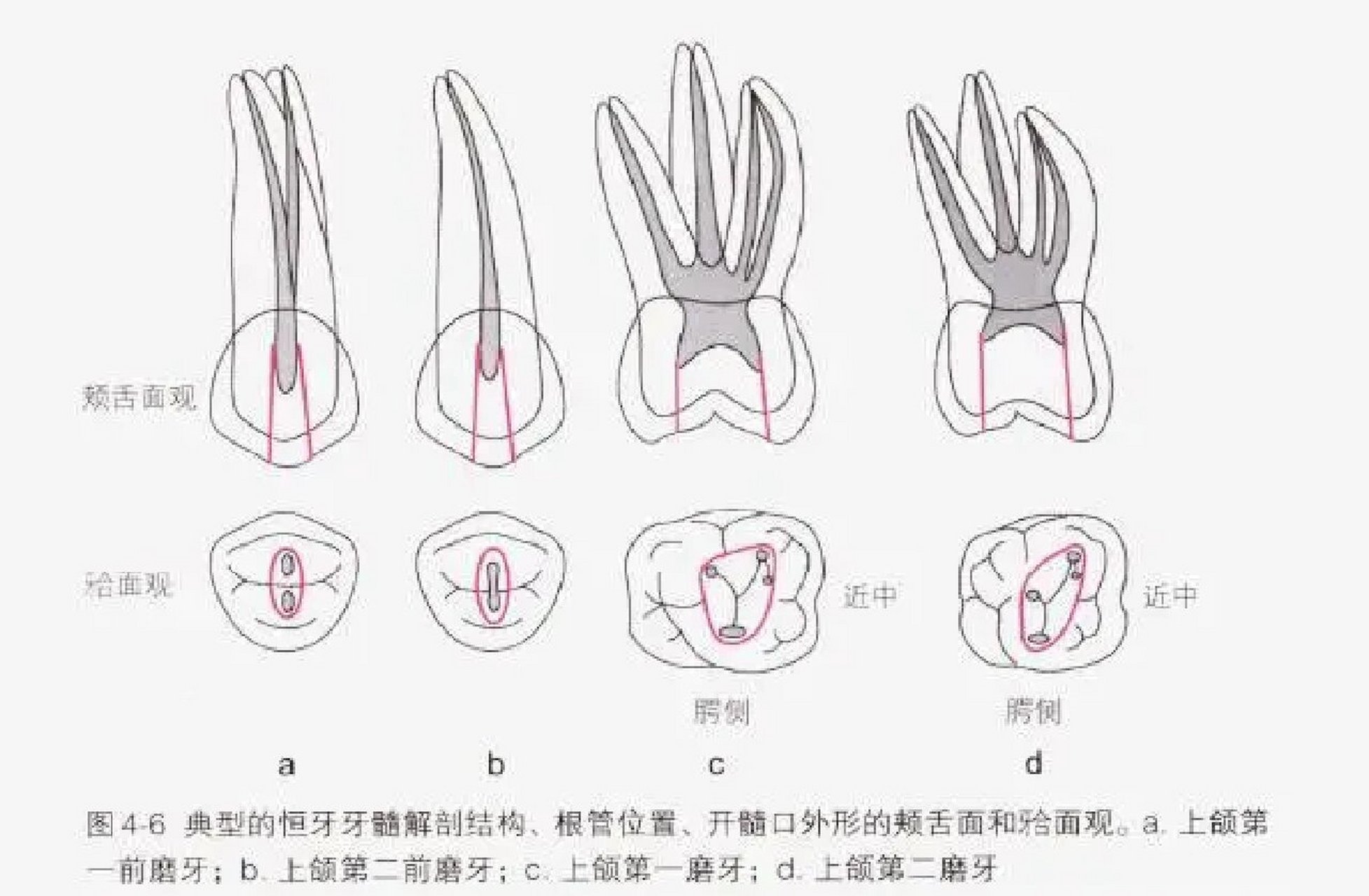 口腔开髓位置图图片