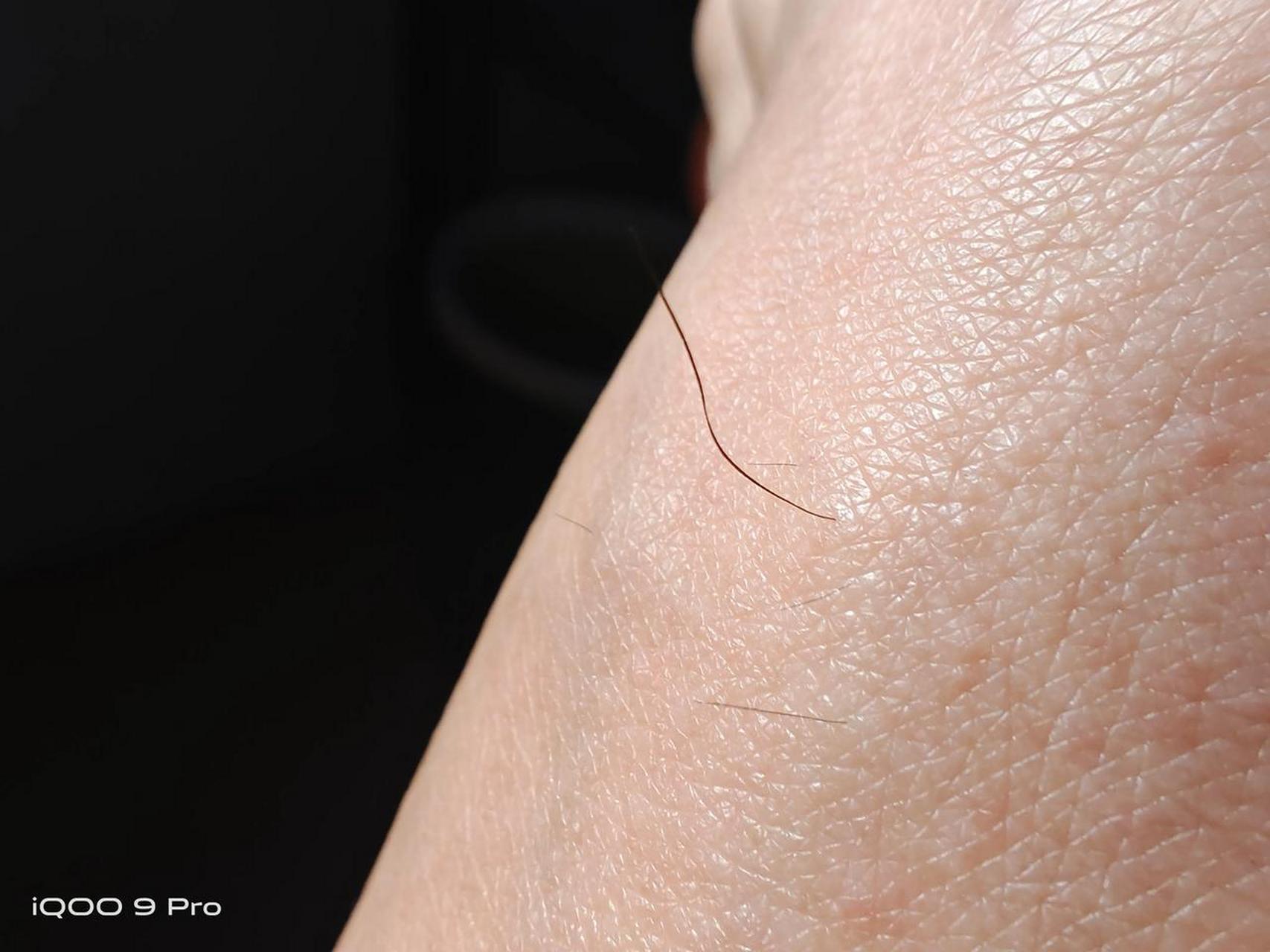 最近发现我的脚背开始长毛了,为什么?