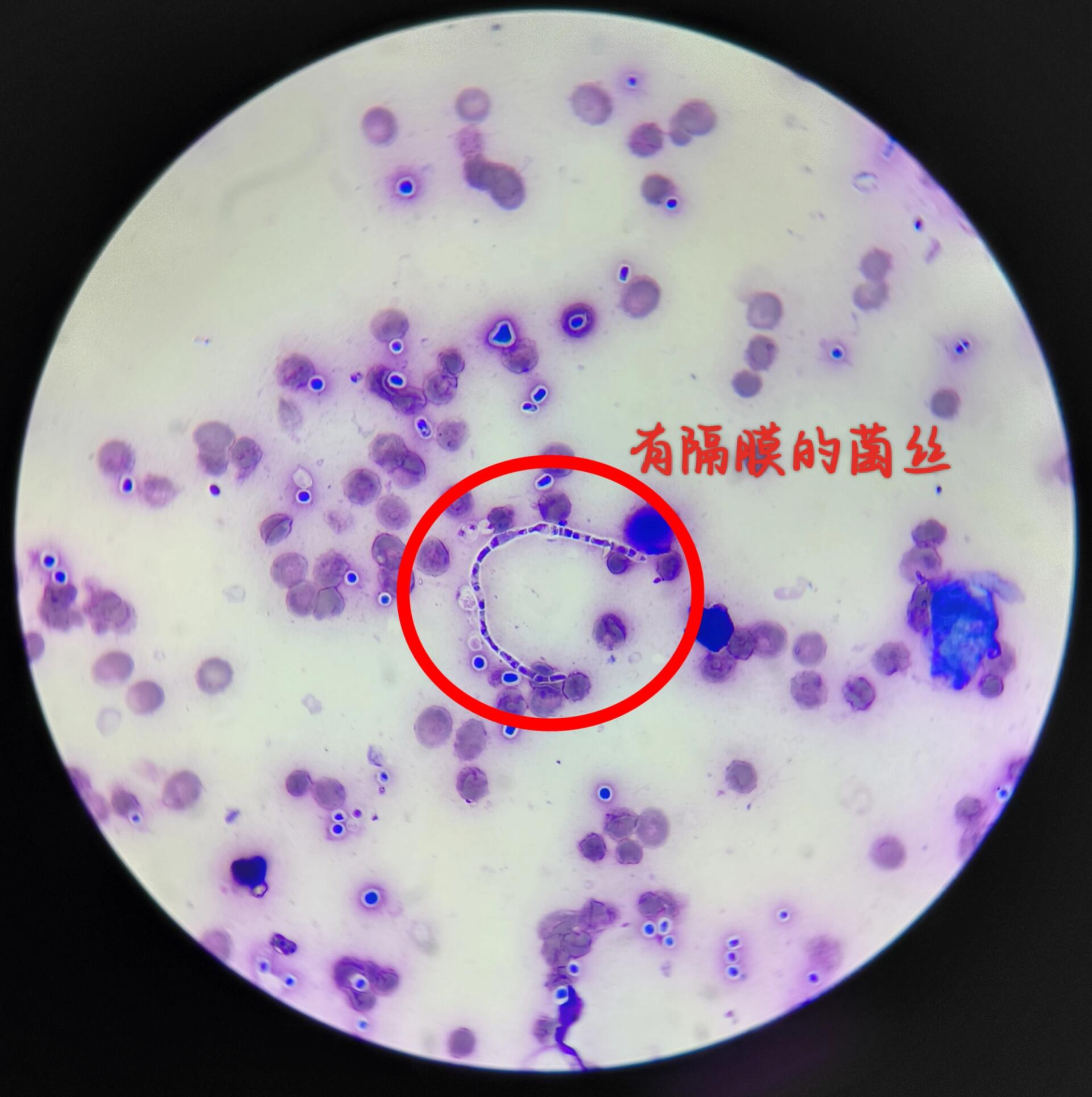 真菌周围有清晰光环,细长有隔膜的菌丝形似竹节.