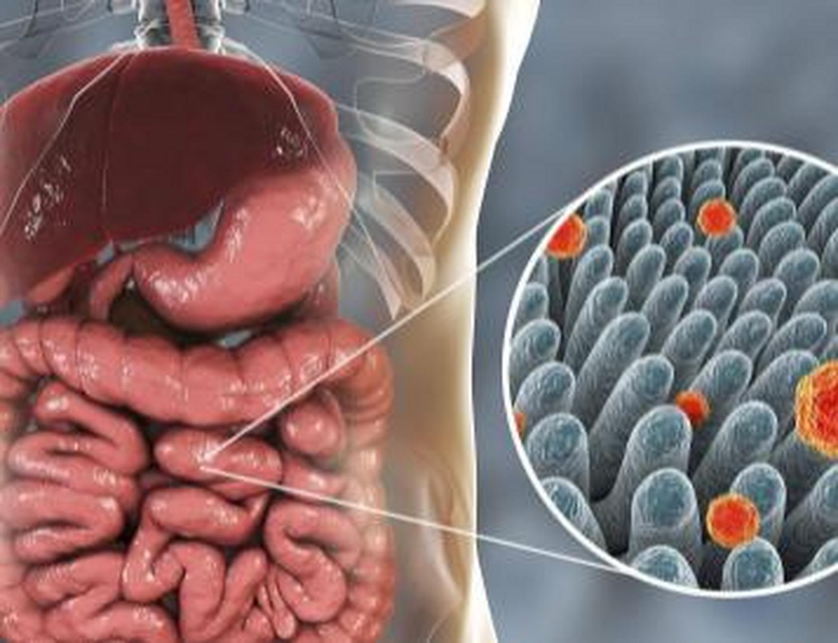 结肠癌五大早期症状,出现一定要重视  结肠癌早期症状较不典型,因此