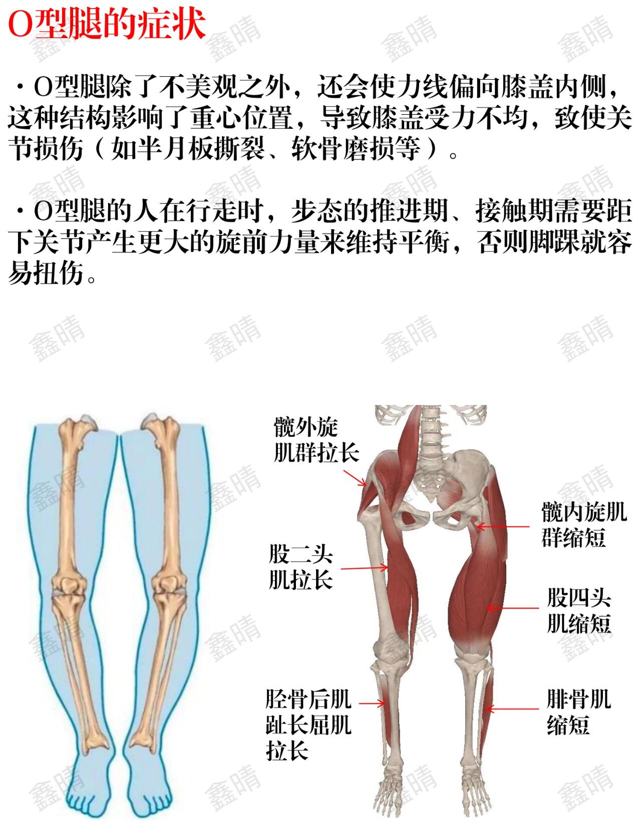 腿部名称图解大全图片图片