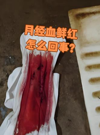为什么血是红色的