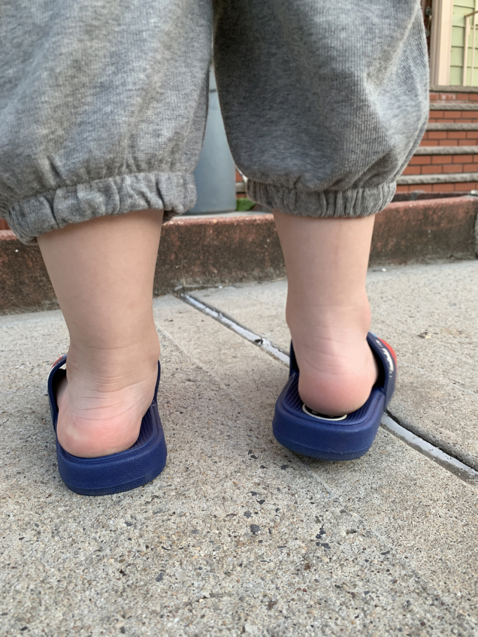 宝宝三岁 发现有些足外翻 以前就觉得宝宝走路姿势"大摇大摆" , 经常