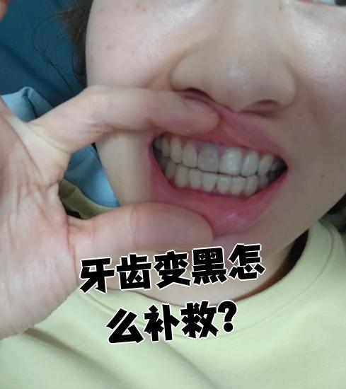 牙为什么会变黑牙齿人的牙齿为什么会变黑为什么在线