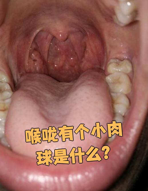 下面具体说明这些情况: