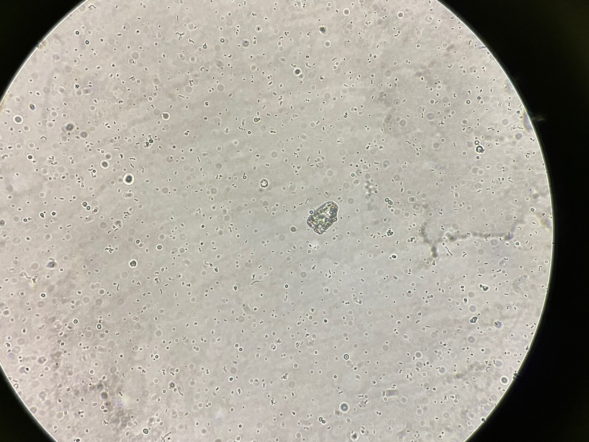 检验科工作日常|粪便常规中红白细胞live