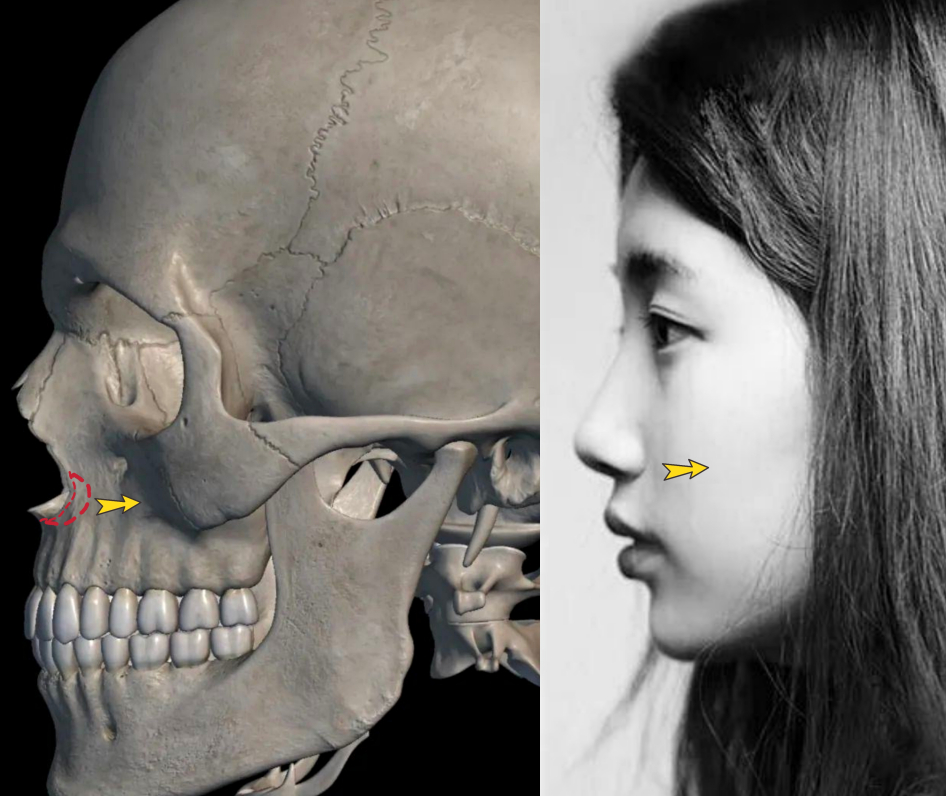 鼻基底对面中饱满度有什么影响?