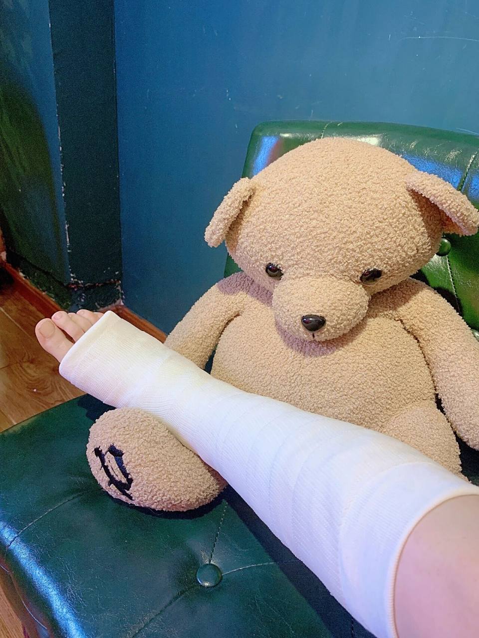 瘸子美女第一次打石膏 白色的石膏还挺好看的吧,显得腿好细