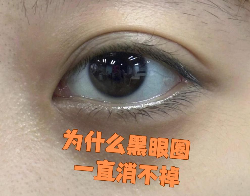 肾不好三处变黑百科在线