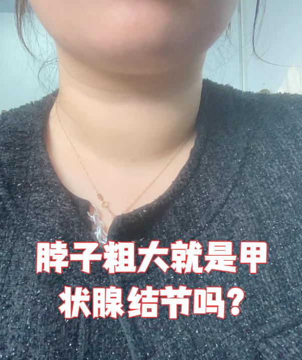 脖子粗大不一定就是甲状腺结节,需要结合检查结果来判断