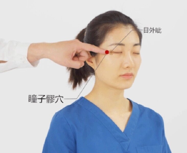 定位:目外眦外侧0.5寸.