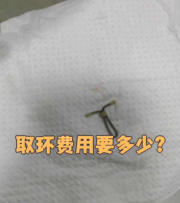 手术前需要拍x片或者做盆腔彩超,确认节育环的位置