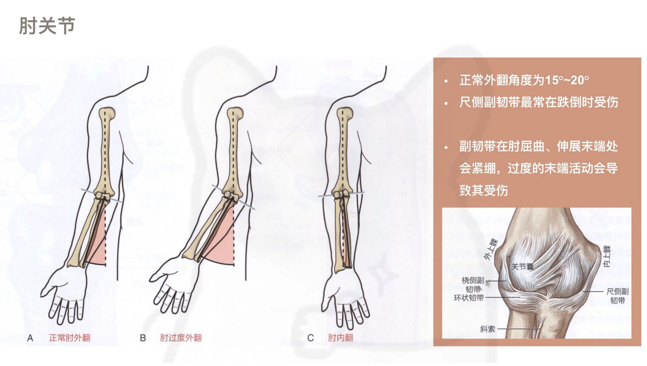 肘关节外翻测量图示图片