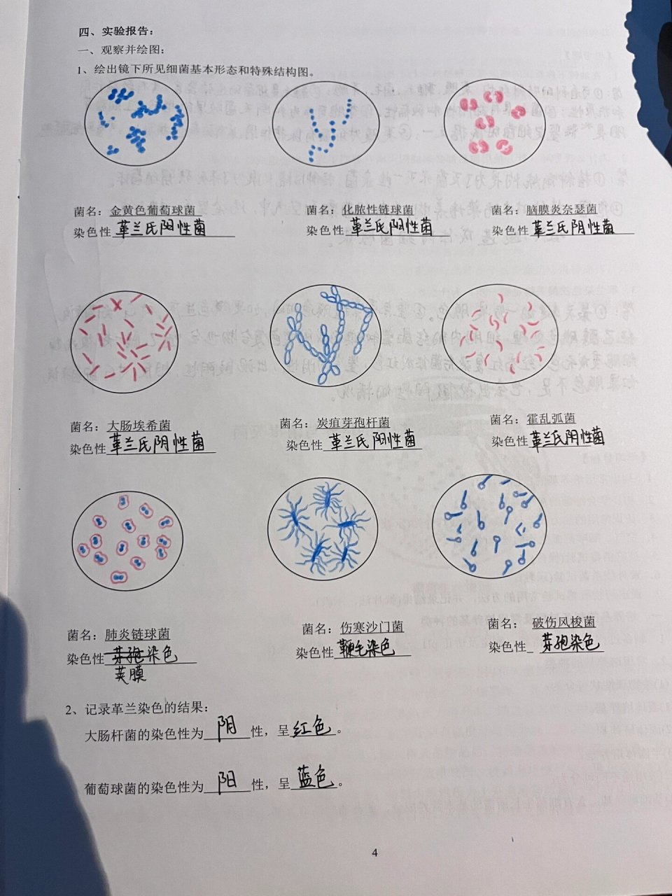 肺炎双球菌结构图片