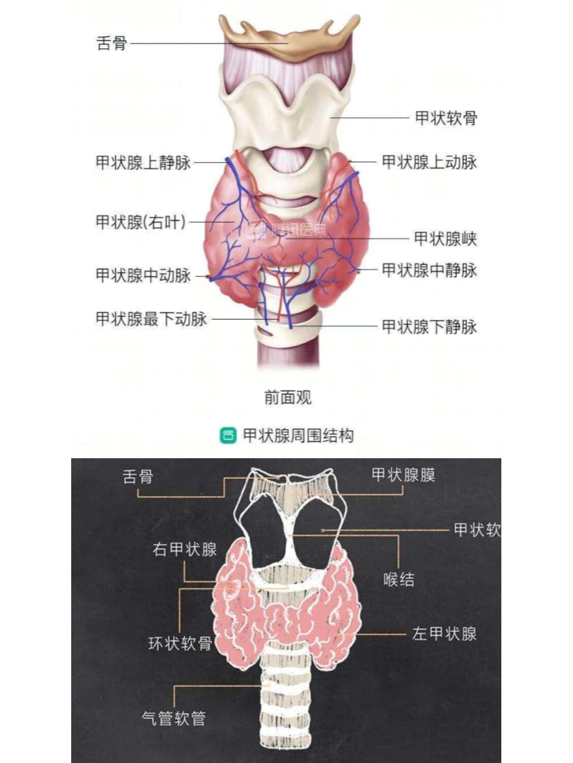 甲状腺肿大分度图片