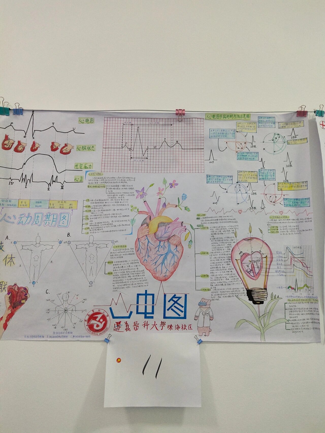 心电图还能这么画 这个是俺们的心电图思维导图!