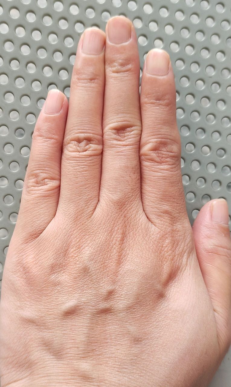 无名指比食指长这么多,苦难啥时候到头呢!