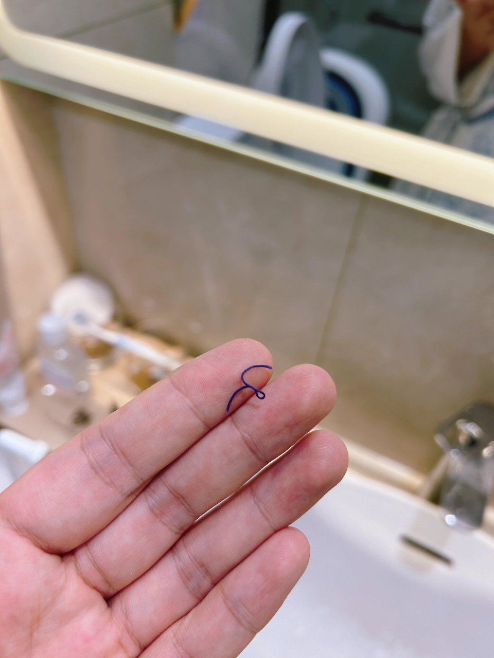 月子第28天的线头掉啦 缝合伤口的线头晚上洗澡的时候掉出来了,被我